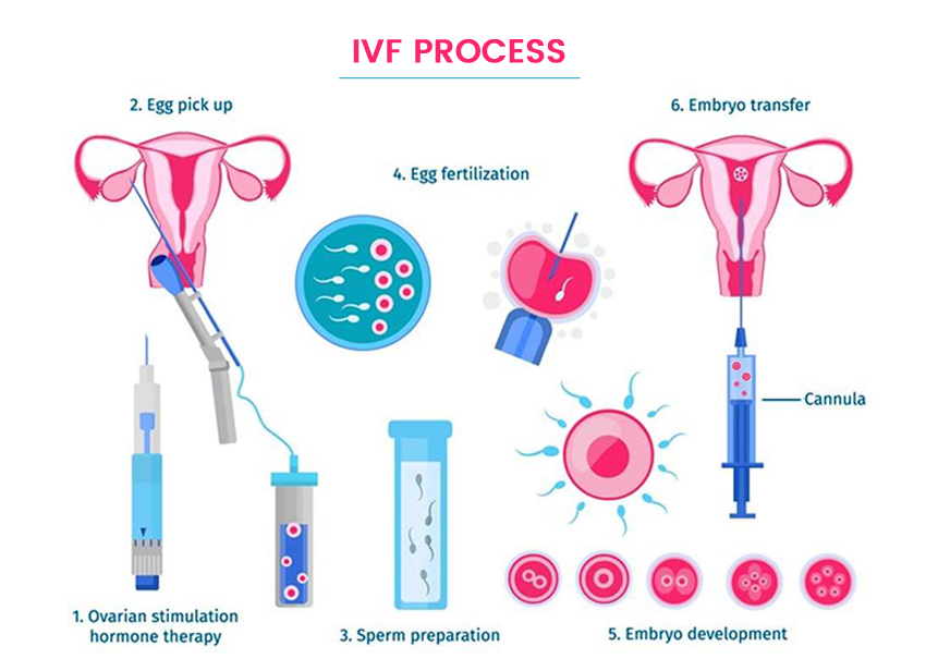 Best IVF center in Delhi NCR