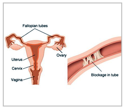 Best IVF center in Delhi NCR