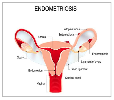 IVF clinic in Delhi NCR