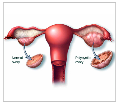 Best IVF clinic in West Delhi